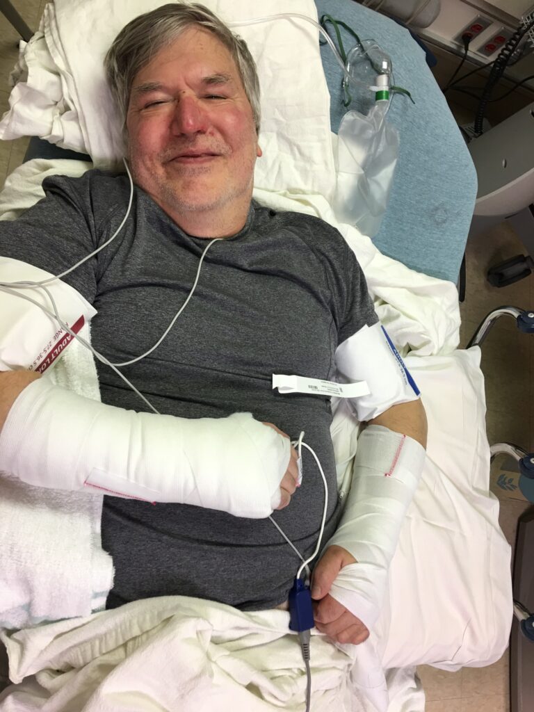 Paul after having his wrists surgically repaired.